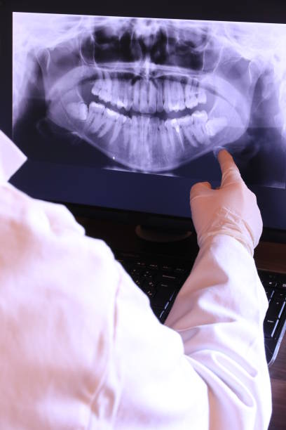 Best Emergency Root Canal Treatment in Laurel, VA
