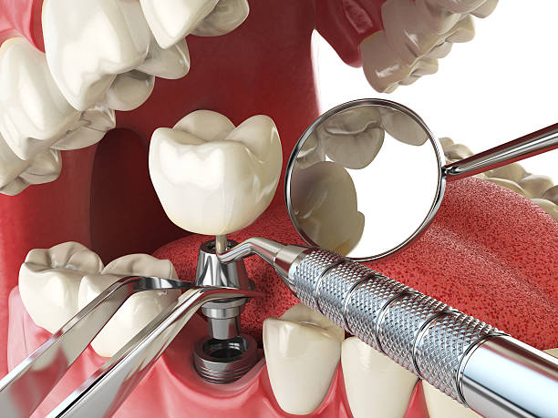 Best Broken or Cracked Tooth Emergency Dentist in Laurel, VA