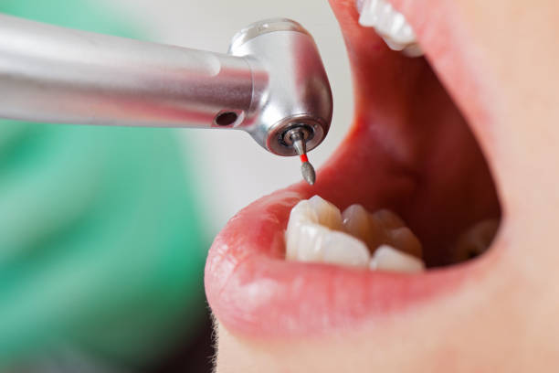 Best Emergency Dentist for Knocked-Out Tooth in Laurel, VA